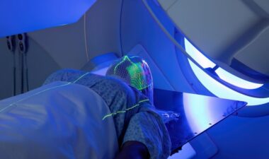 About Radiation Therapy for Head and Neck Cancers