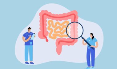 What You Need to Know About Colorectal Cancer & Screening