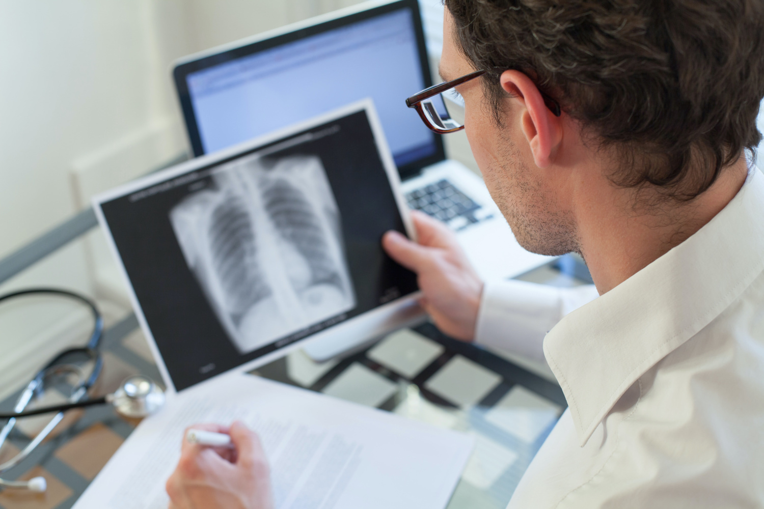 doctor looking at x ray to determine lung cancer